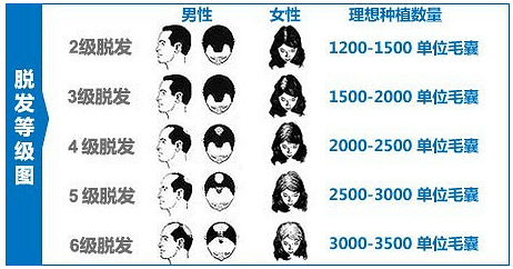 影响植发手术价格的因素有哪些?植发费用贵吗