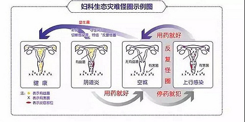 杭州红房子专家解答:为什么妇科炎症这么容易