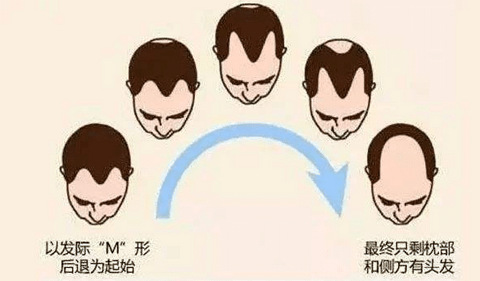 西安看头发种植最好医院_西安科大医院