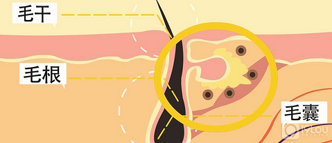 脱发治疗最好的时机是什么时候?