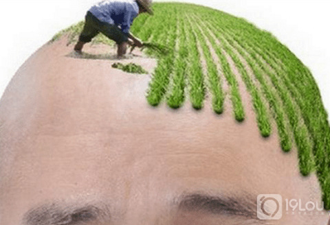 宁波新生植发揭晓:植发究竟靠不靠谱!