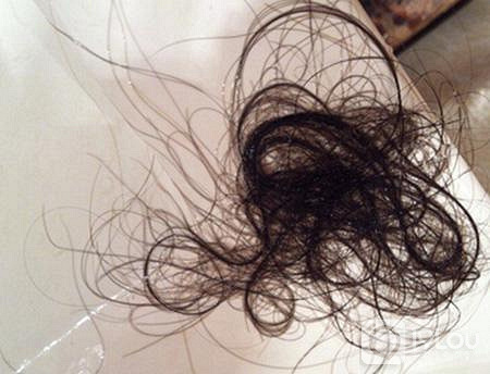 不知道为了什么,脱发它围绕着我!