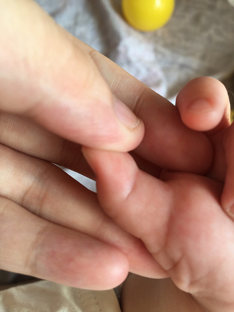 七个月大婴儿左手大拇指伸不直_19楼手机版