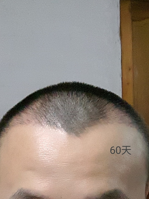 杭州科发源植发