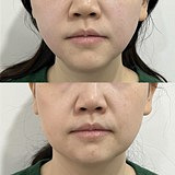 �����˥��Ŀ̫��Ч��