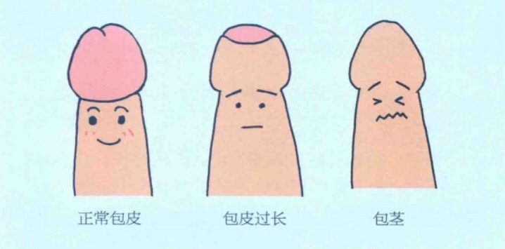 又到了给小男孩们拨香蕉的季节了！护理学起来！
